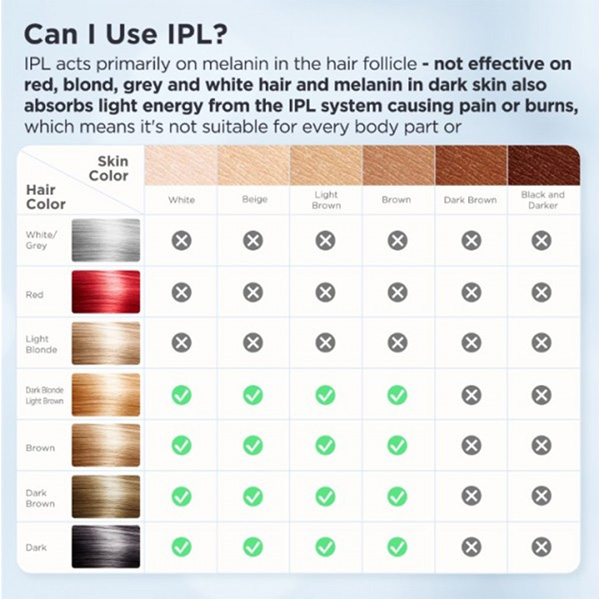 دستگاه لیزر اینزا TM016 از نوع IPL خانگی