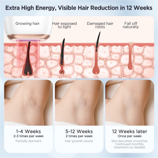 دستگاه لیزر اینزا TM016 از نوع IPL خانگی